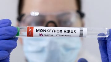 La OMS ha declarado la viruela del mono como una emergencia de salud pública mundial. Aquí lo que debes saber de la vacuna.
