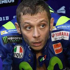 El padre de Rossi: "Ha sentido mucho dolor en la pierna"