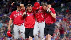 El infielder de los Angels abandon&oacute; el duelo del martes frente a los Rangers con un golpe en la pierna y la organizaci&oacute;n ya revel&oacute; la gravedad de la lesi&oacute;n.