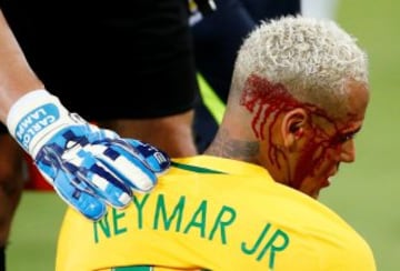 Neymar recibe un fuerte golpe en el duelo ante Bolivia (octubre). Es ayudado por el portero de Huachipato Carlos Lampe. Recuento gentileza de El País.