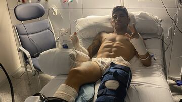 Jorge Martín tras sus operaciones en Barcelona.