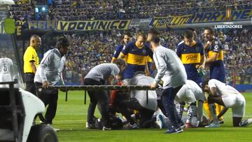 Jugador de Boca corre por la camilla al ver una triple fractura