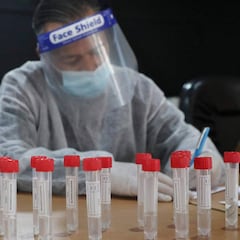 Primer caso de recombinación de coronavirus: "Una versión híbrida muy mutada del virus"