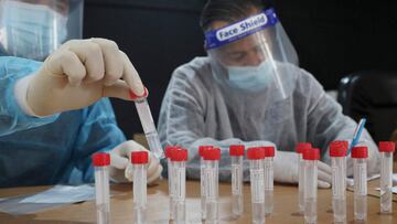 A health worker handles tubes of gathered samples while testing for COVID-19 coronavirus disease in the Palestinian village of Dura, southwest of Hebron in the occupied West Bank, on February 16, 2021. (Photo by HAZEM BADER / AFP)