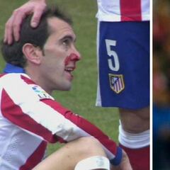 Cuando Godín y Mandzukic acabaron de esta guisa en un derbi