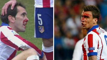 Cuando Godín y Mandzukic acabaron de esta guisa en un derbi