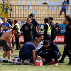 “Tuvo una conmoción cerebral con compromiso de conciencia y fracturas de macizo facial”