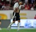 Colo Colo revela la lesión de Arturo Vidal