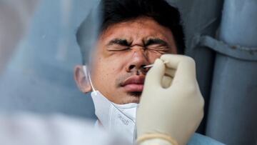 El síntoma que puede ser sinónimo de tener una COVID leve