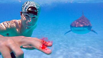 Un chico con gorra muestra sus dedos ensangrentados en el mar, con un tibur&oacute;n de fondo.