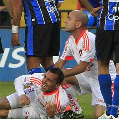 Ubilla sufre fractura de tibia y peroné ante Huachipato