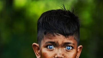 El síndrome Waardenburg, la rara condición genética que está cambiando el color de ojos de tribus de Indonesia