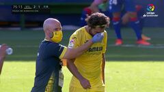 Patada voladora: Asenjo le rompe la nariz a Albiol