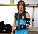 Puyol mejora de su luxación de codo y ya no lleva escayola
