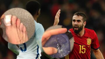 Carvajal shows off his battle scars after England game
