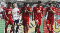 Las lesiones que complican el esquema de Kudelka en la U