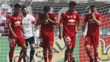 Las lesiones que complican el esquema de Kudelka en la U