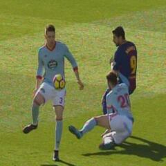 Sergi Gómez: luxación del hombro tras forcejear con Suárez