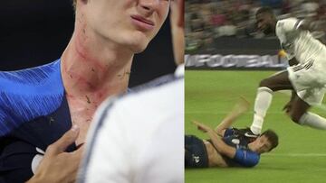 Rudiger clavó los tacos en el cuello de Pavard.