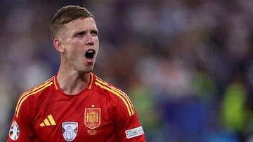 El Multi Combipartido para la final de la Eurocopa y la Copa América 2024