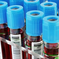 Se intensificarán los controles antidopaje en el Mundial