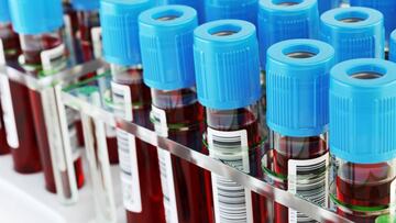 Se intensificarán los controles antidopaje en el Mundial