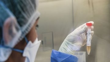 Variante C37 en Perú: qué se sabe y a qué regiones ha llegado