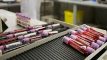 Brasil vio su único laboratorio acreditado por la AMA perder la licencia por no cumplir con las normas mínimas internacionales.