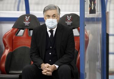 Ancelotti se apunta 'goles' gracias a su mano izquierda