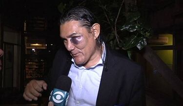 Rafael Dudamel, DT de Venezuela, fue denunciado por una agresión en Uruguay