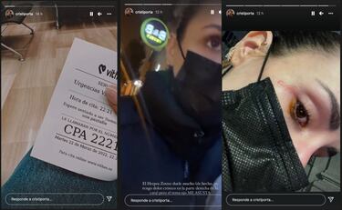 El problema de salud de Cristina Porta que puede causarle ceguera