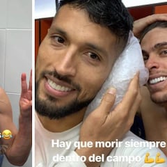 Así quedó el rostro de Gabriel Paulista tras el partido