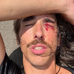 Danny León sufre un accidente surfeando en Bali