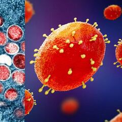 MPOX en Quintana Roo: ¿Qué es, cómo se contagia y principales síntomas?