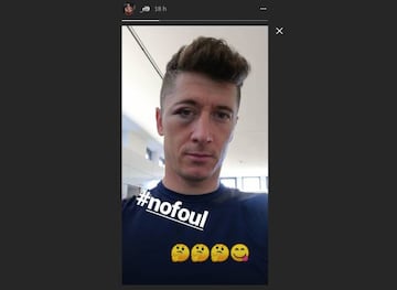 Así quedó la cara de Robert Lewandowsi (Bayern Munich) tras chocar con Gabriel Mercado (Sevilla).