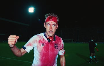 Terry Butcher sangrando en un duelo de la selecci¨®n inglesa frente a Suecia en el Mundial de Italia 1990.