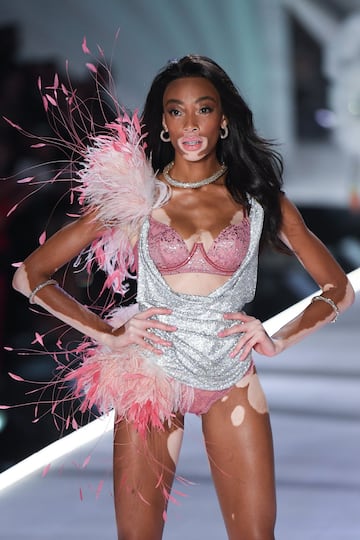 Winnie Harlow en el desfile de Victoria's Secret Fashion Show de 2018 celebrado en Nueva York.