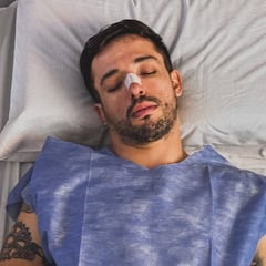 El campeón olímpico de BMX freestyle se opera de la nariz: “Vuelvo a respirar”