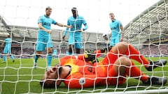 Lloris: Spurs keeper suffers serious arm injury at Brighton