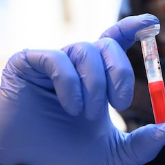 Qué son los test PCR genéticos para detectar el coronavirus