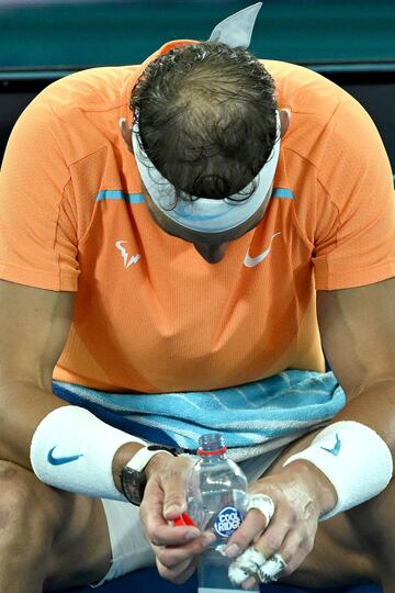 Rafa Nadal ha perdido en el Abierto de Australia contra el estadounidense McDonald tras sentir dolores en su cadera que no le han dejado continuar con normalidad.