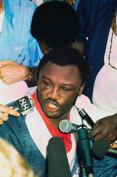 Así quedó el ojo del boxeador nacido en Beaufort, en el estado estadounidense de Carolina del Sur.