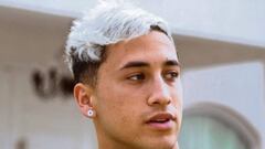 El influencer Yao Cabrera se cayó de un tercer piso: su estado es delicado