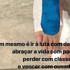 Neymar enseña en Instagram el estado de su pie lesionado