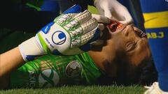 "No puedo jugar con máscara"