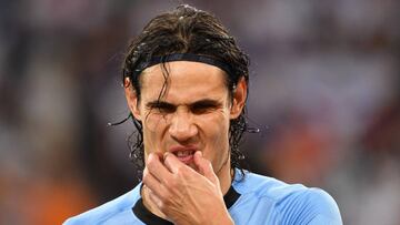 El cuerpo médico de la selección charrúa afirma que el delantero sufre una lesión edematosa en el músculo gemelo interno de su pierna izquierda.