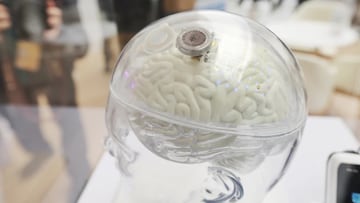 The device can be implanted in people with severe paralysis who cannot grasp objects with their hands, but who retain some functionality in their upper arm.