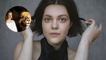 La enfermedad rara que sufri車 Georgie Henley, Lucy en &Las cr車nicas de Narnia*: ※Casi me quita la vida§