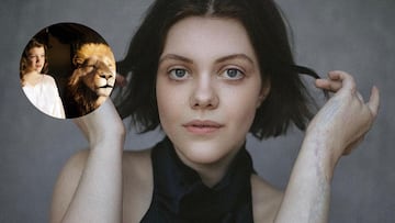 La enfermedad rara que sufrió Georgie Henley, Lucy en ‘Las crónicas de Narnia’: “Casi me quita la vida”