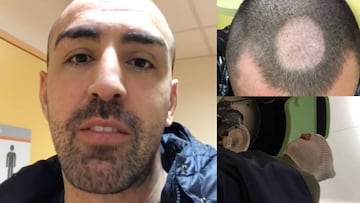 El exfutbolista José Enrique comparte en Instagram su lucha contra el cáncer